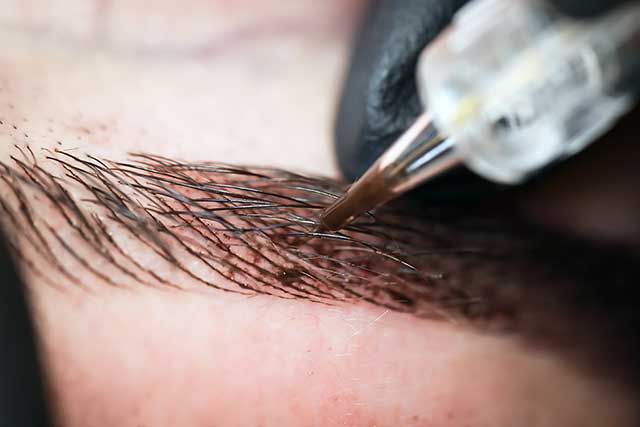Microblading, or semipermanent eyebrow tattooing, is a popular trend in the beauty industry.